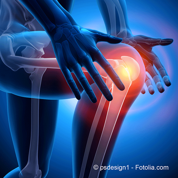 L’arthrose : une fatalité ?