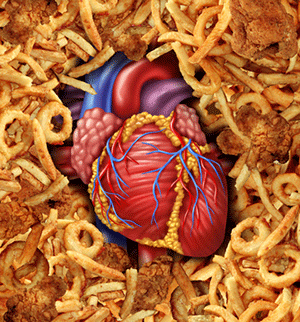 Cholestérol et statines : intérêts financiers ou médicaux ?