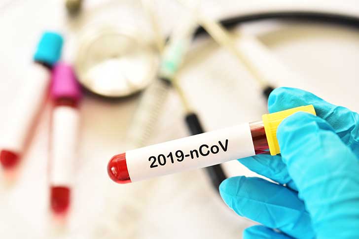 Les Franais sont inquiets de la progression du coronavirus le Covid-19