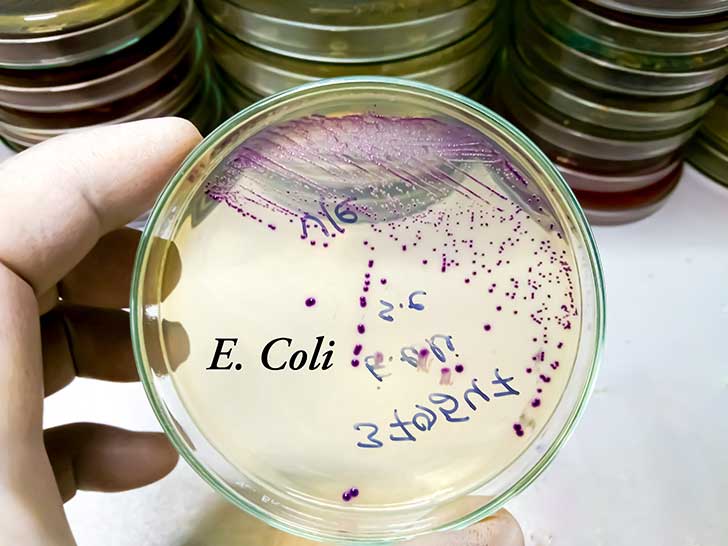 Contamination  la E. coli  Saint-Quentin : une ville sous tension face  la crise sanitaire