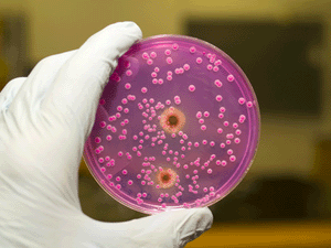 Insuffisance des antibiotiques face aux bactries multirsisantes