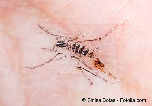 LOMS craint larrive massive des moustiques porteurs du Zika en Europe