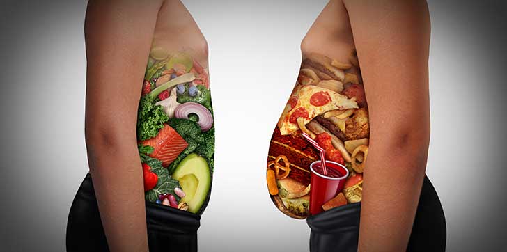 L’obésité touche plus d’un milliard de personnes dans le monde, la France n’est pas épargnée (Erik Kauf)