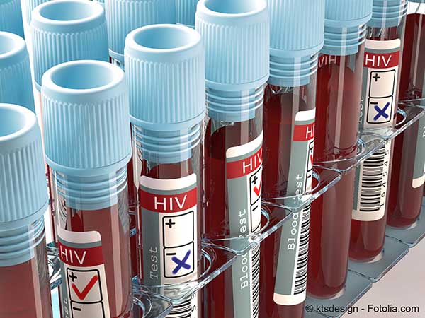 L’ONUSIDA plaide pour une nouvelle approche de la lutte contre le sida
